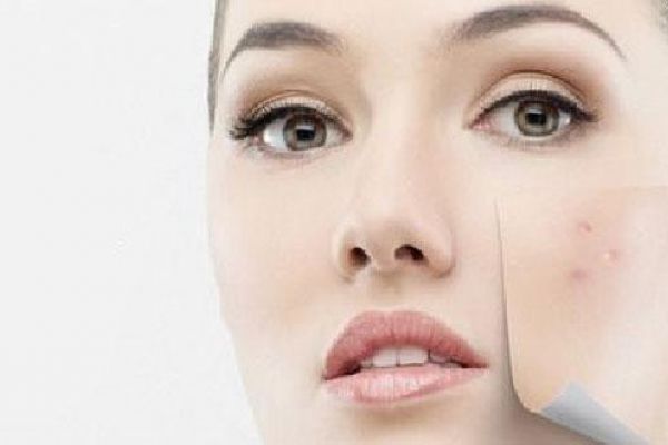 خلطات تخلصك من البثور